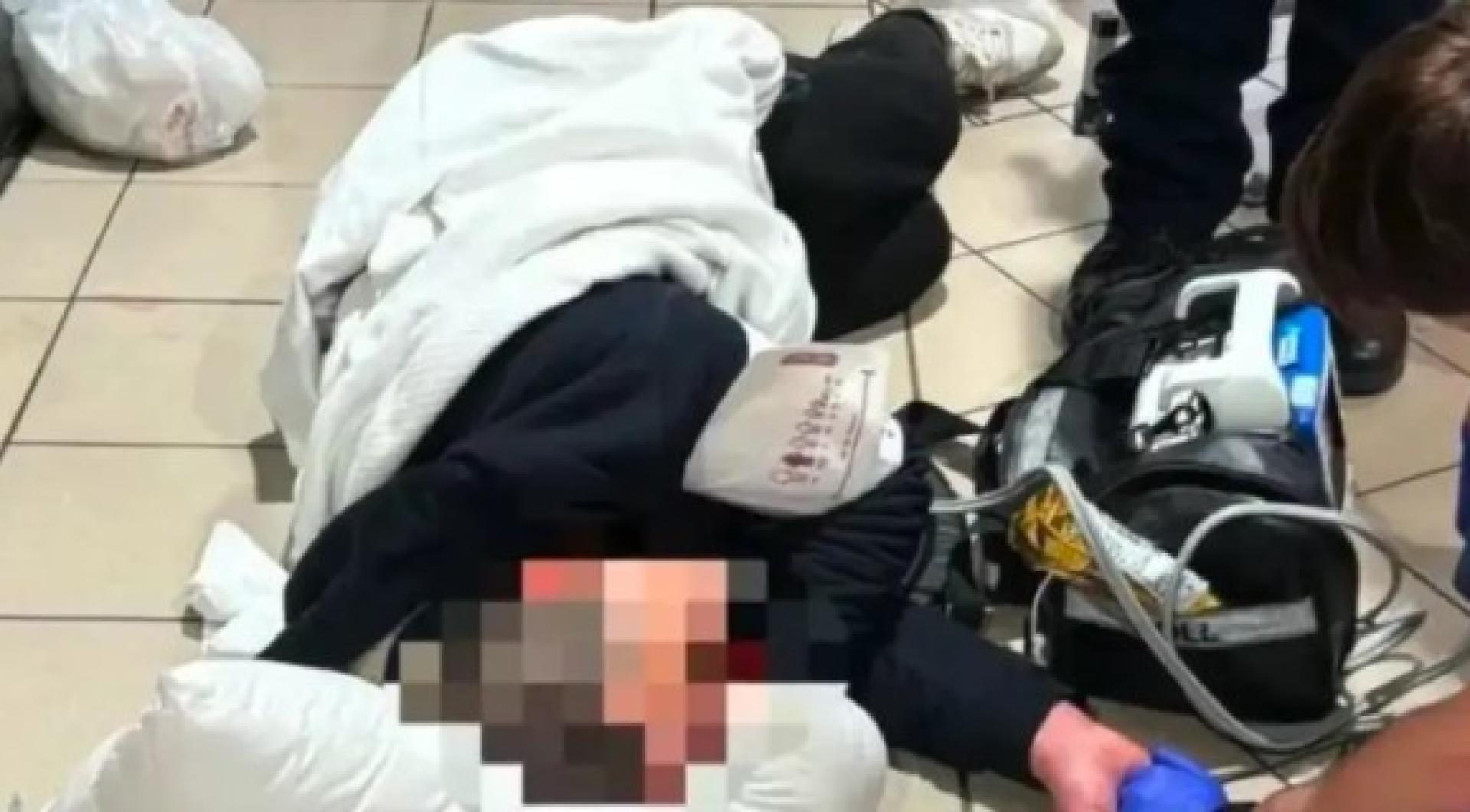 男子头部遭到重击，导致脑部出血、脑震荡、颅骨和脸部骨折。