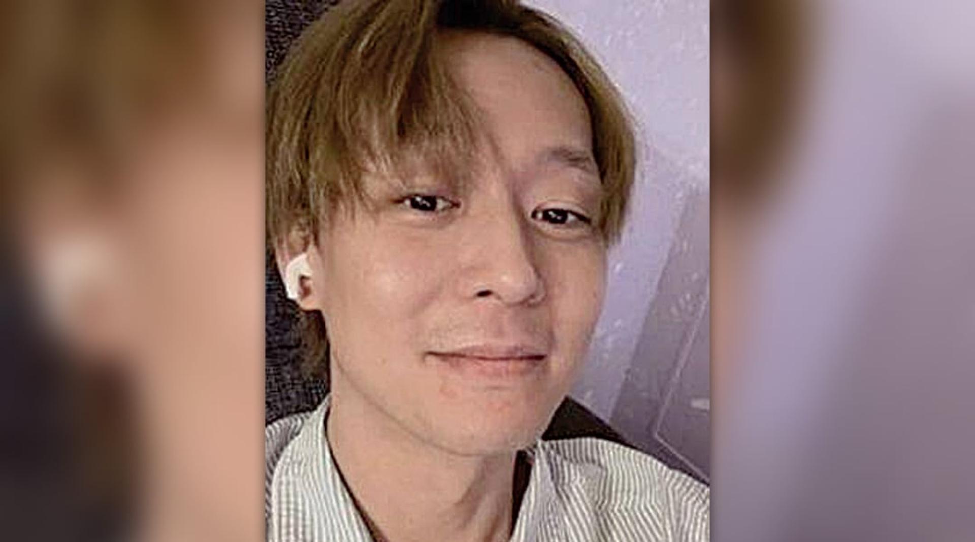 摘下帽子的朴有天明显可见发量稀疏。