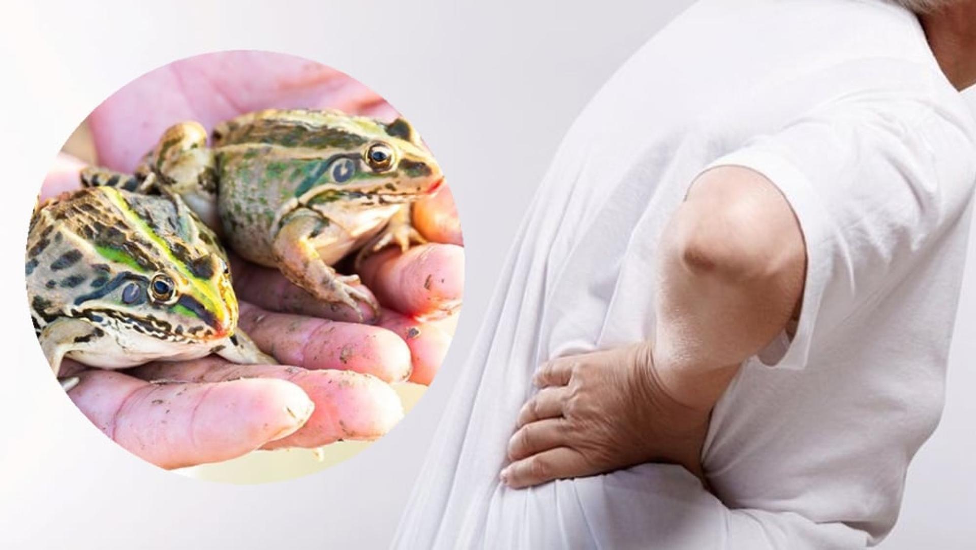 老妇因腰痛难忍，轻信“生吞青蛙可治腰痛”的偏方，竟接连吞下八只活青蛙，结果导致身体陷入危机。