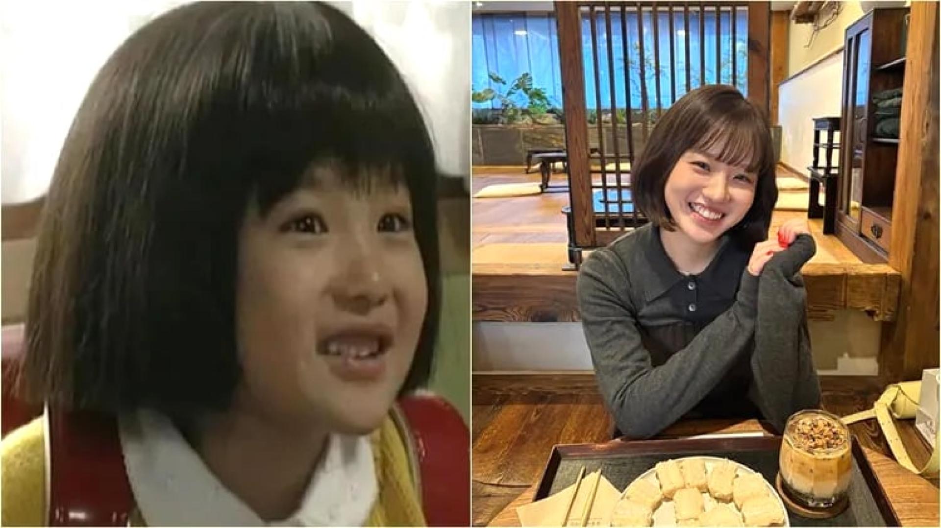 过去饰演真人版《樱桃小丸子》的童星森迫永依如今28岁了。