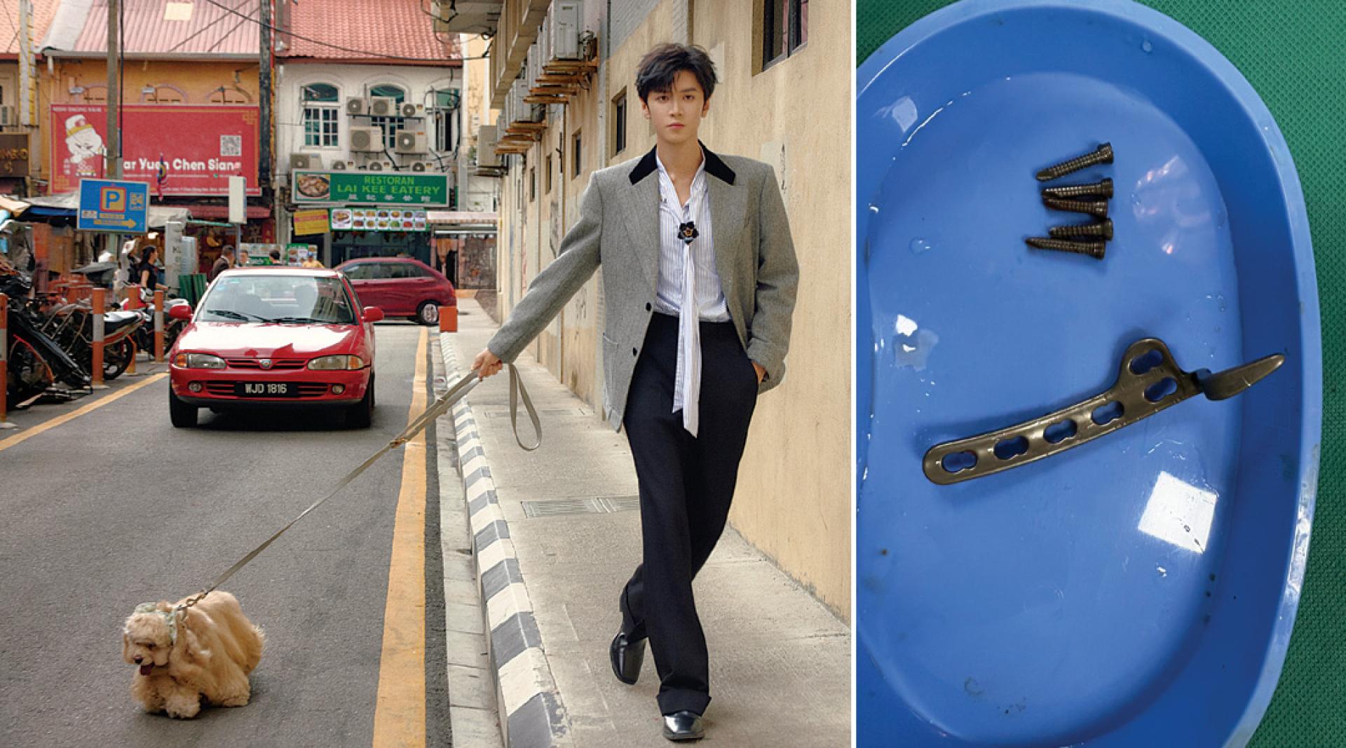 （左）陈哲远日前来马，在街头拍写真。（右）陈哲远晒出钢钉及接骨板的照片。