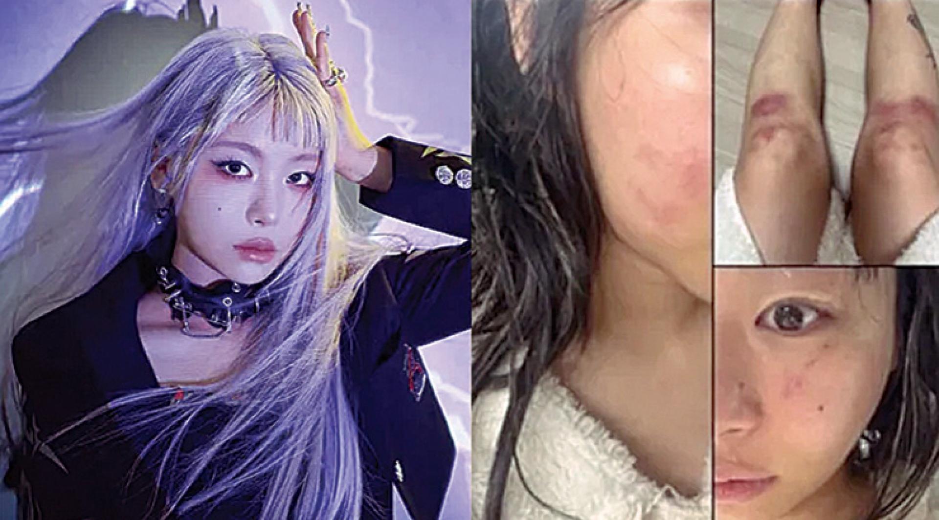 Jvcki Wai在社群平台指控前男友家暴。