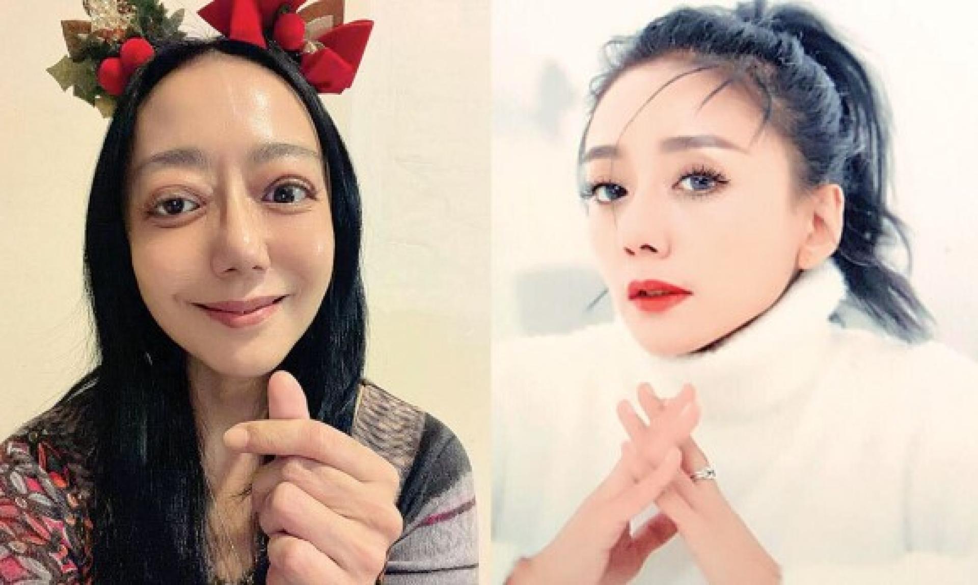 高慧君圣诞节曝健康近况。