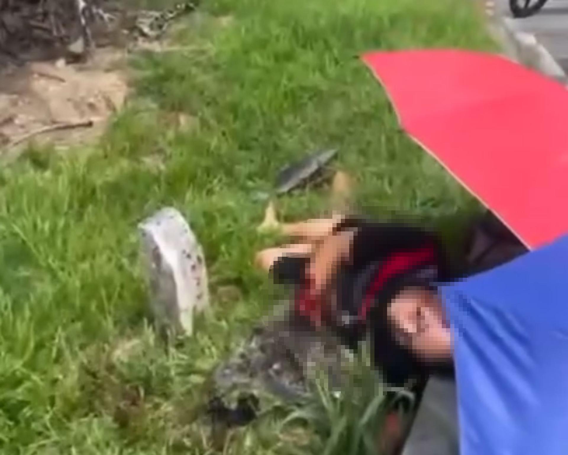 男子右手腕在事故中断裂。