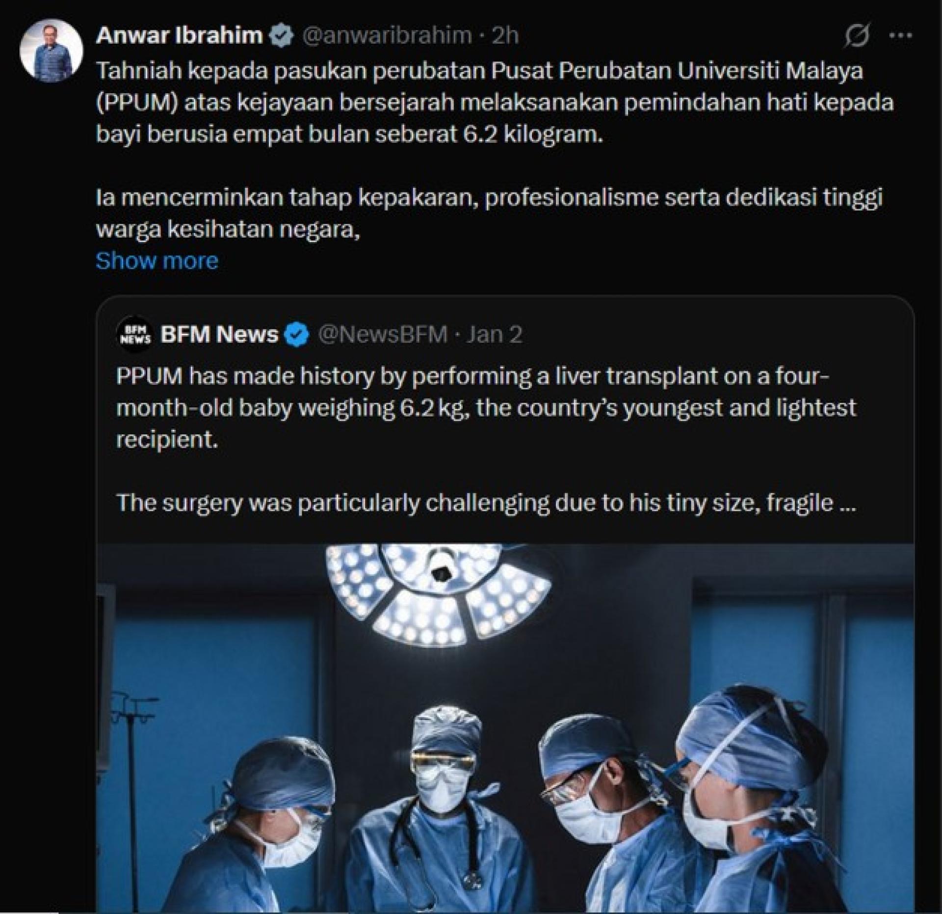 安华在社交媒体平台X上发文，祝贺马来亚大学医药中心（PPUM）的医疗团队达成创举，成功为一名四个月大的婴儿进行肝脏移植。