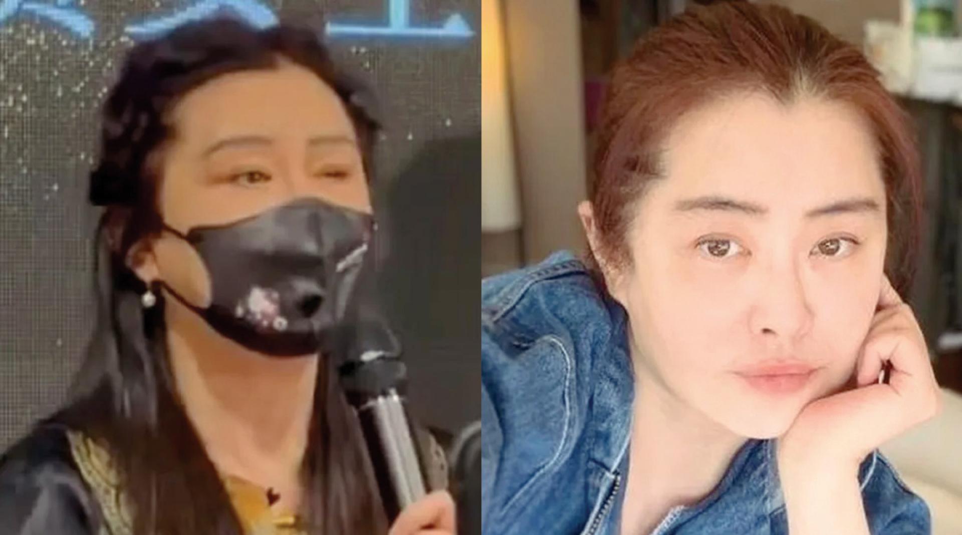 王祖贤元旦在中医论坛开讲（左图），眼部状态引起讨论。