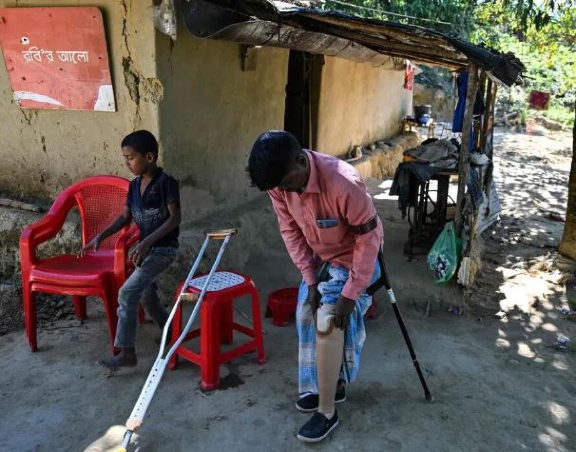 40岁的阿里侯赛因（右）去年初外出收集柴火时误踩地雷，左腿遭炸断；为维持生计，其孩子仍须外出捡柴火，令人唏嘘。