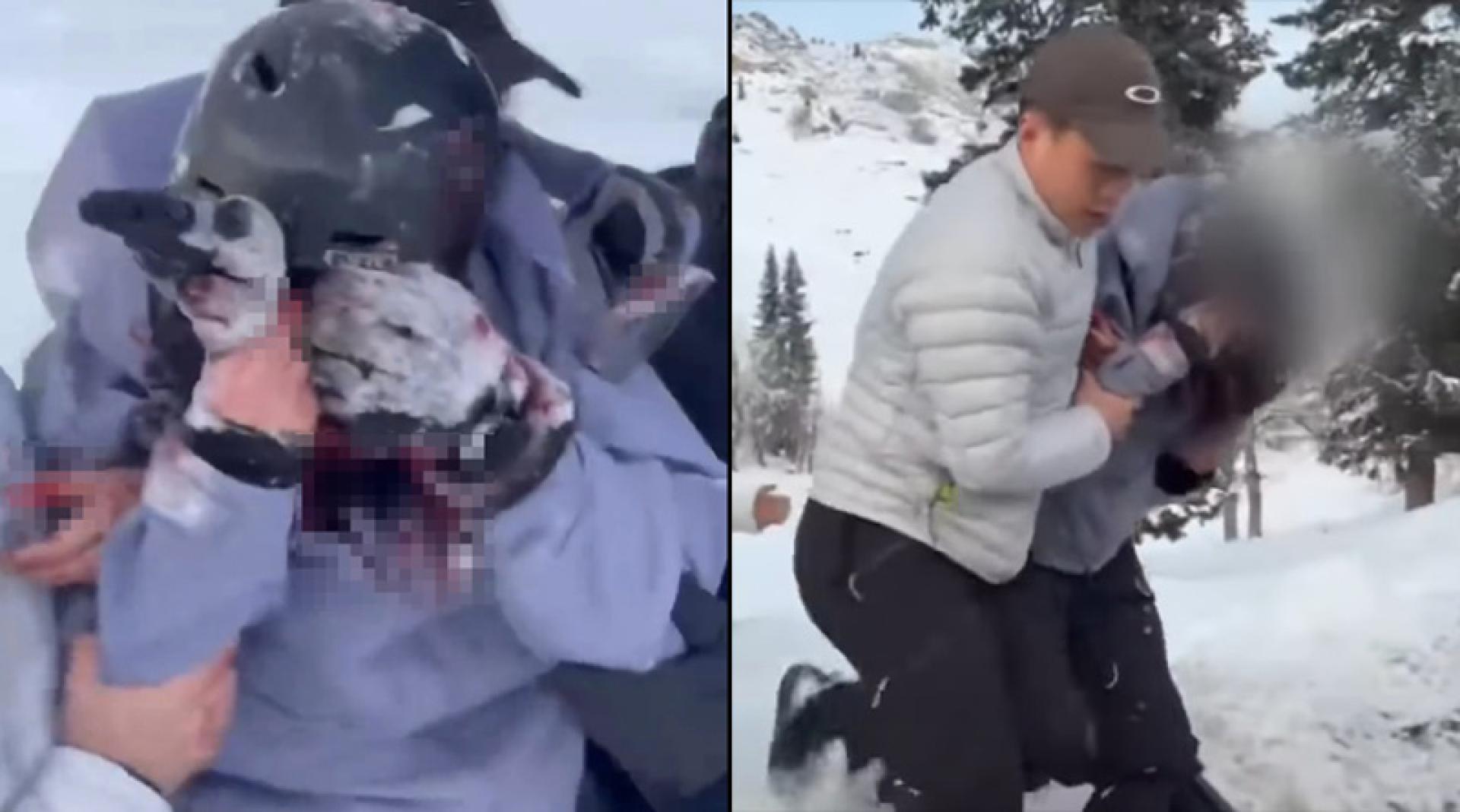 一名身穿紫色上衣、头戴黑色头盔的女游客被多人从雪地里搀扶起来，她用手捂住面部，身上多处有血迹。