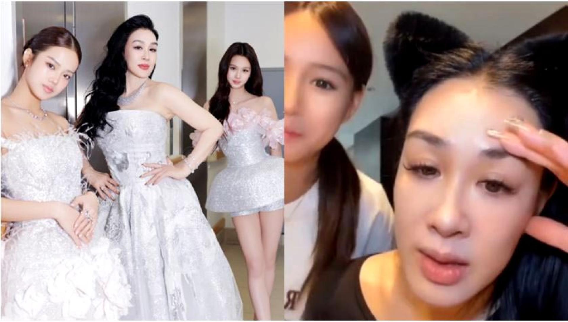 钟丽缇自揭小女儿有天生弱视问题。