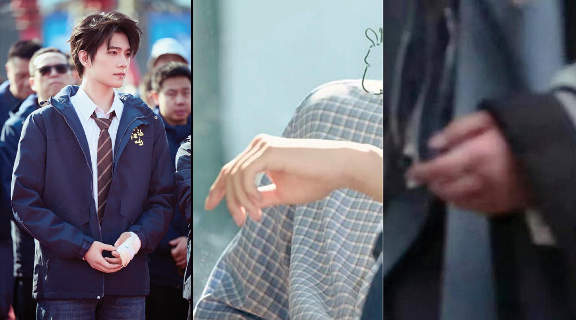 粉丝晒出杨洋（左）在剧组被拍到的手伤照片（右），明显比之前（中）肿了不少。