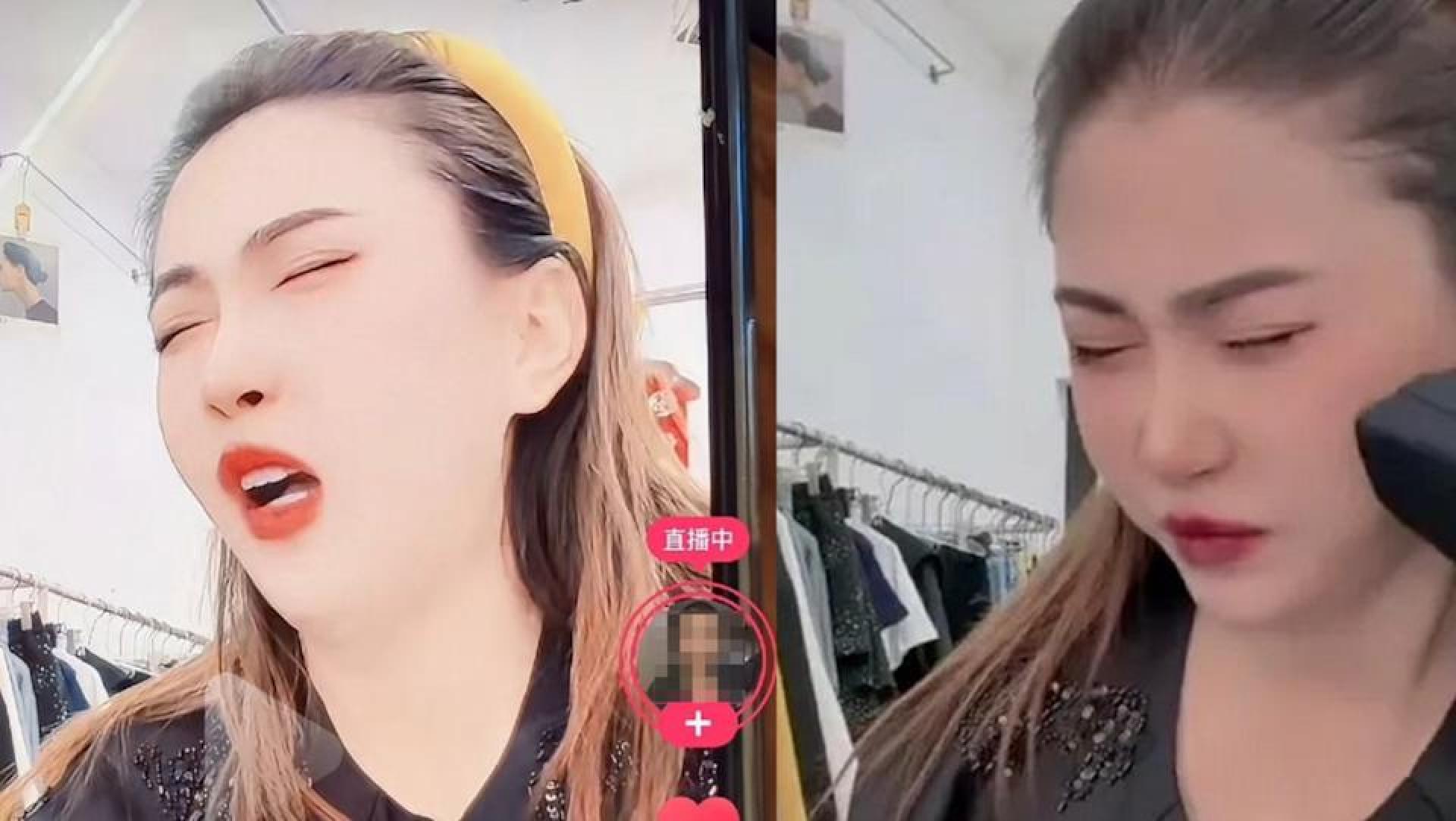 王炸姐在直播时觉得头痛。（取自微博）