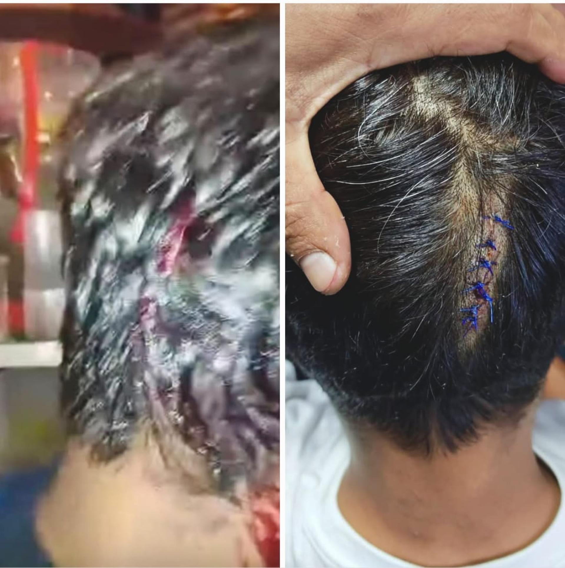 两人头部遭到攻击受伤。（图片来源：Mohd Fadli Salleh）