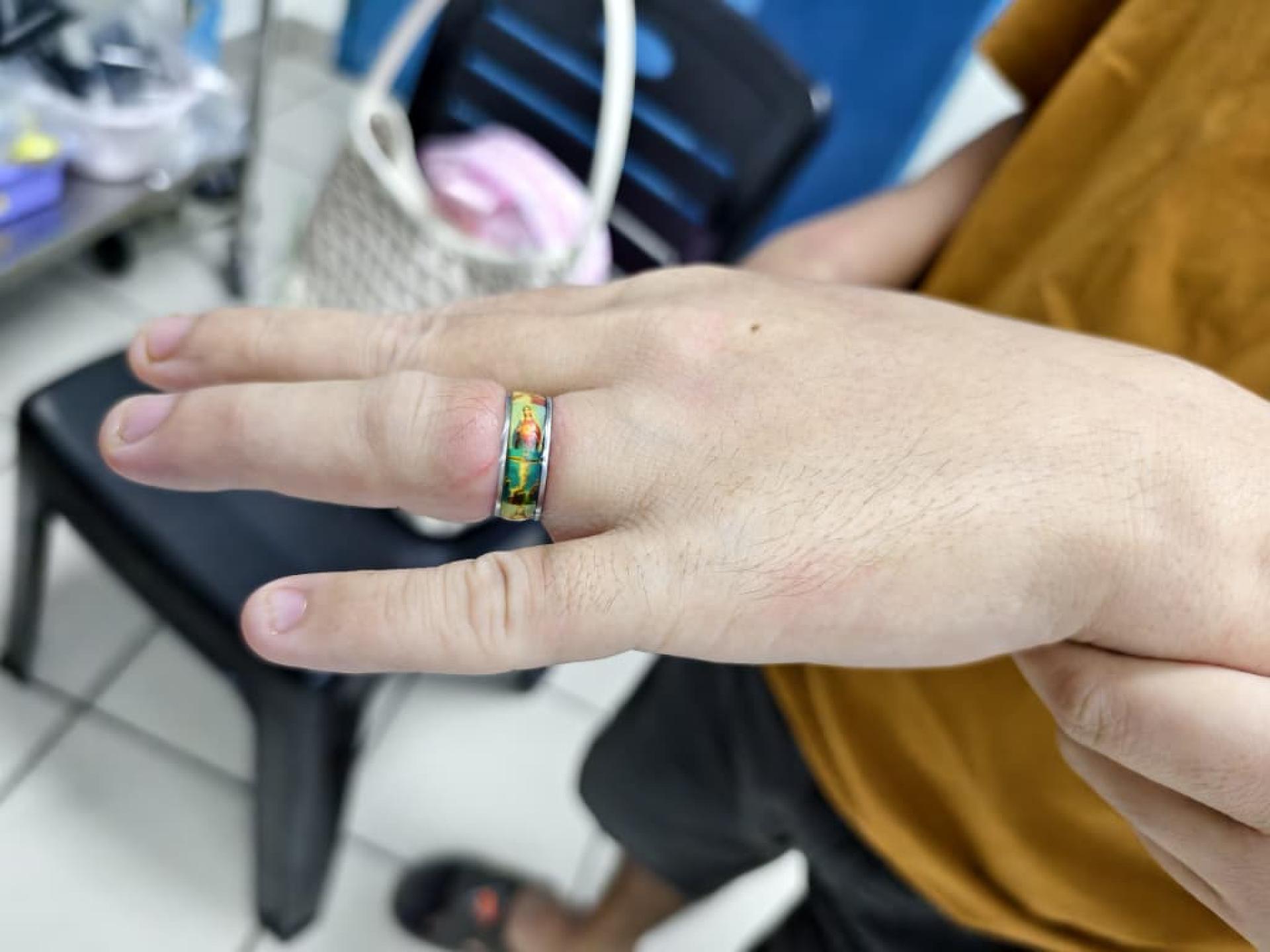 一名民众手指被戒指卡住，求助消拯人员将戒指切除。