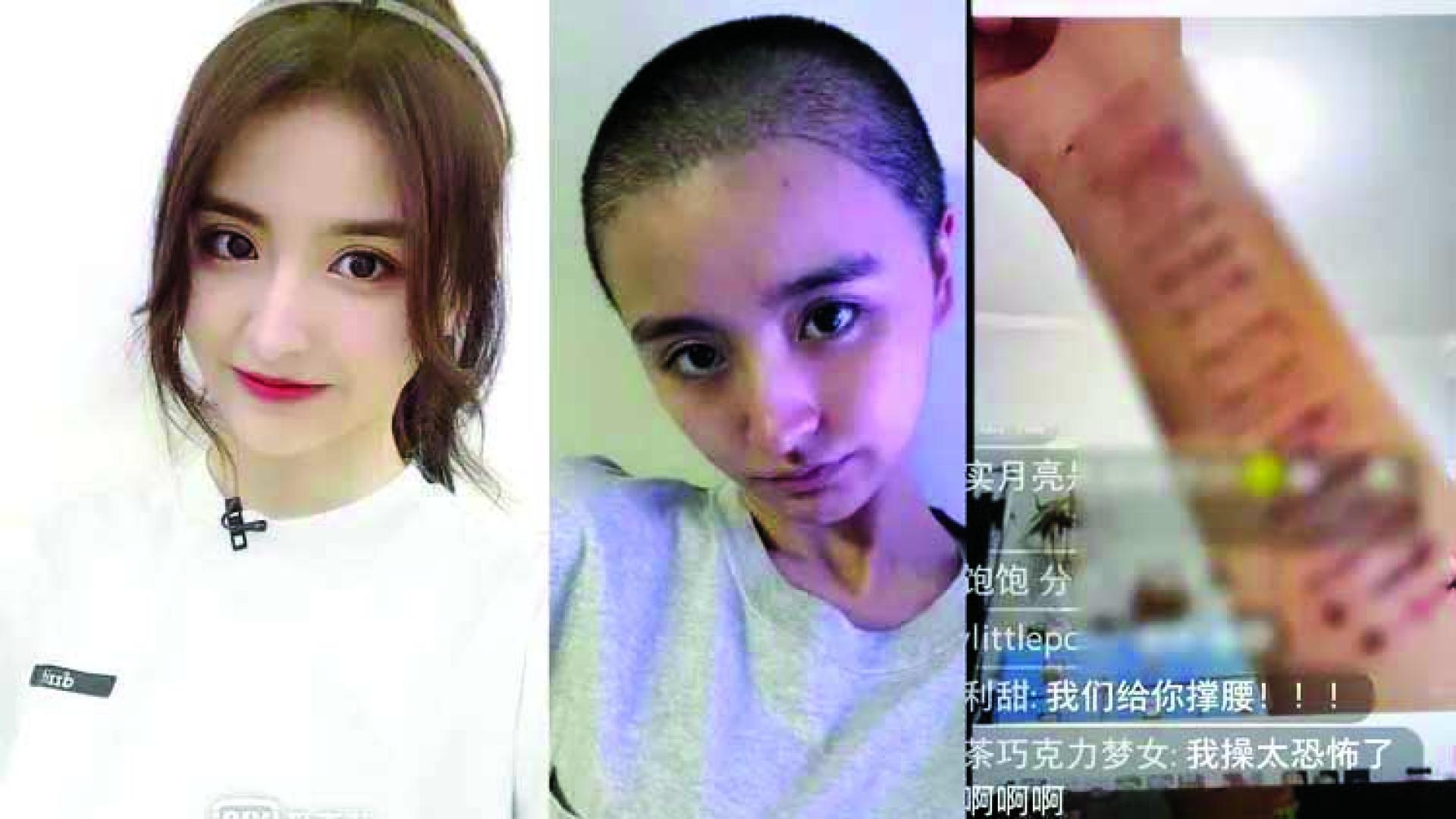 金子涵去年退出演艺圈后，暴瘦又剃平头，开直播控诉被监控和威胁，还因头痛导致自残。