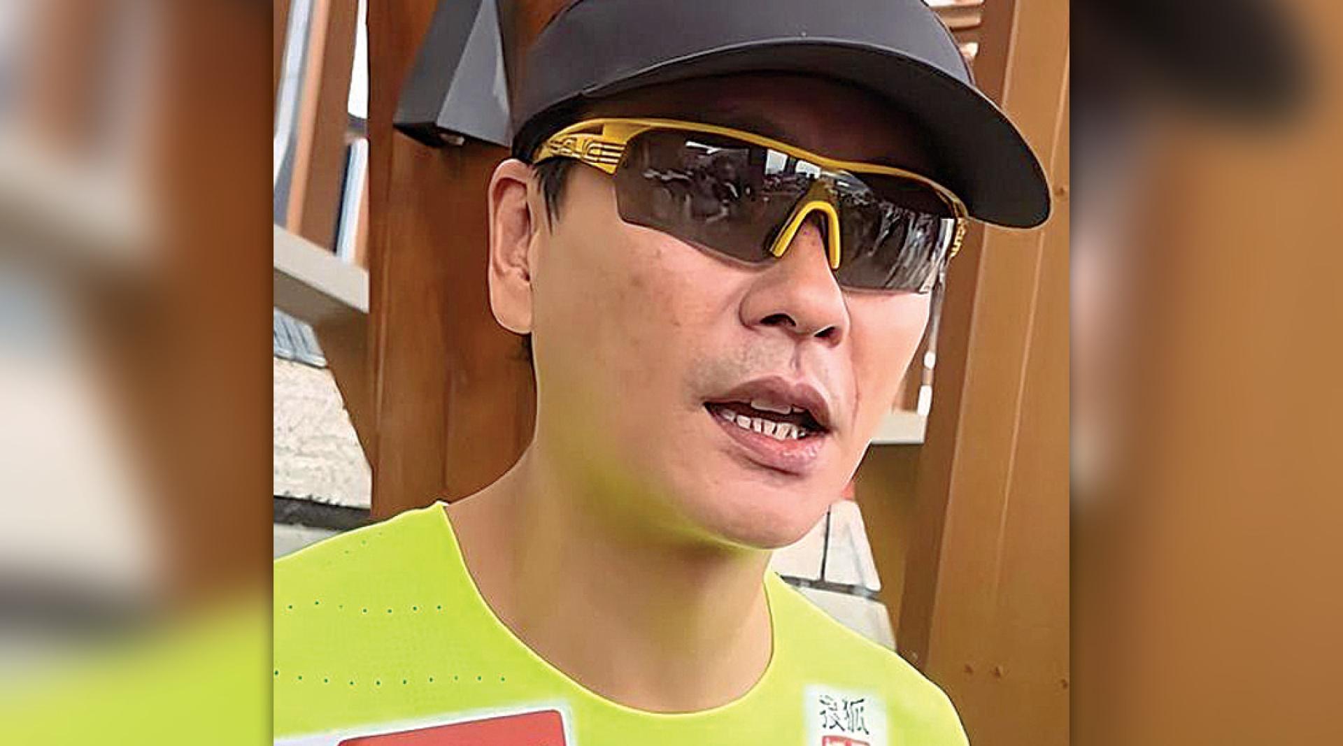 网友指黄宗泽牙龈有萎缩问题。