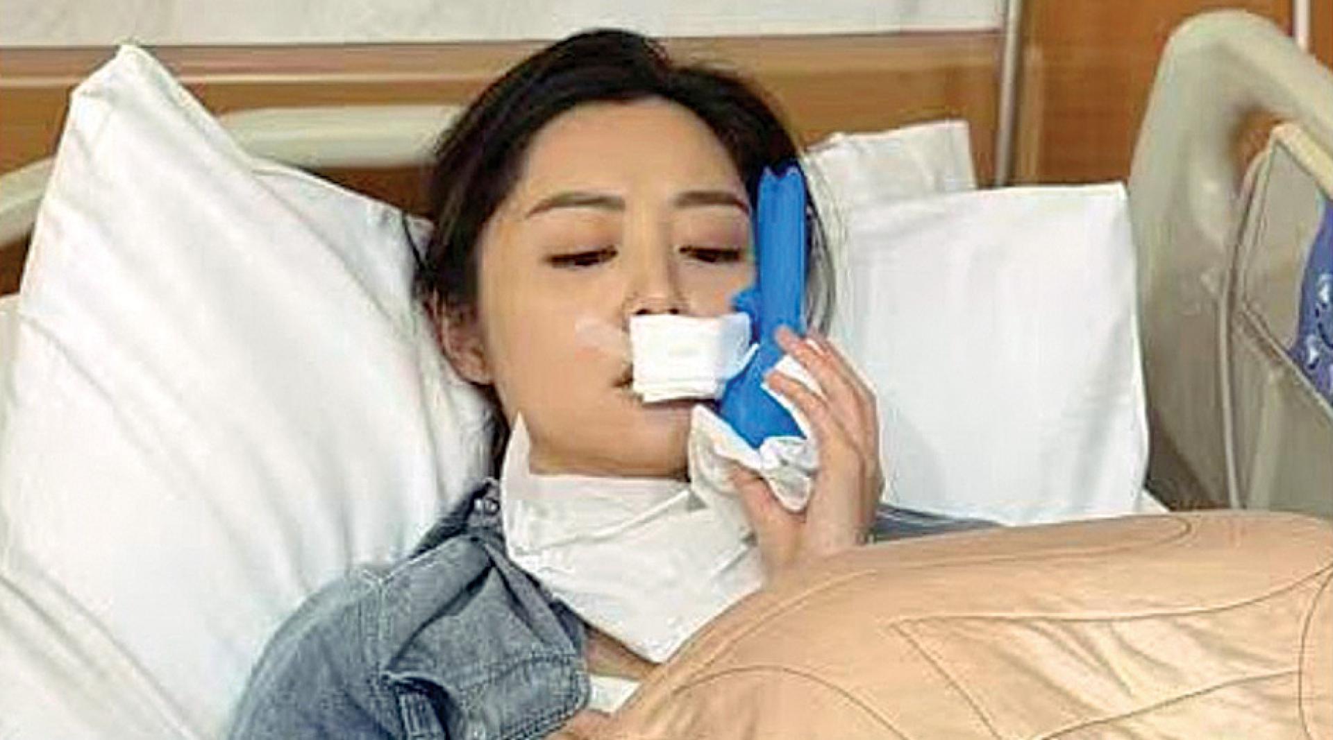 卫诗雅拍剧发生严重意外。